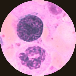 Basofil granulocyt