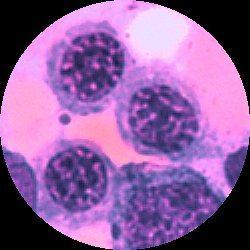 Basofila erythroblaster
