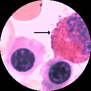 Eosinofil myelocyt