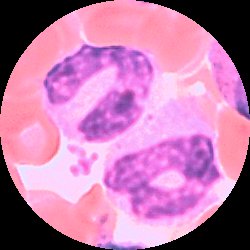 Två neutrofila stavkärniga granulocyter