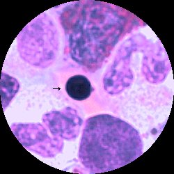 Ortokromatisk erythroblast