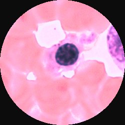 Polykromatofil erythroblast