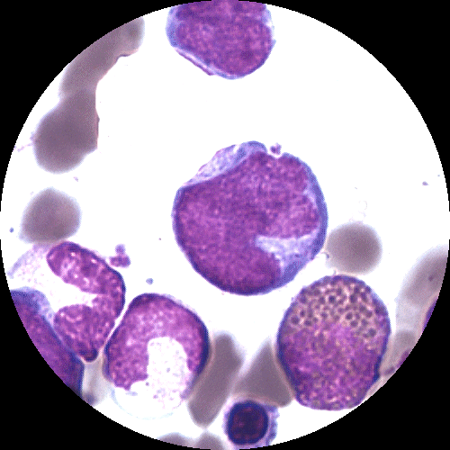 Cellen centralt i bilden är en promonocyt