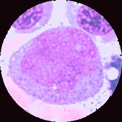 Myeloblast