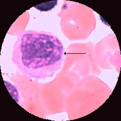 Neutrofil myelocyt